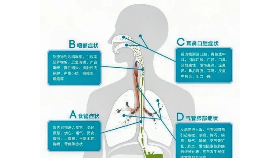 盐巴戟天的作用与功效-爱游戏体育下载